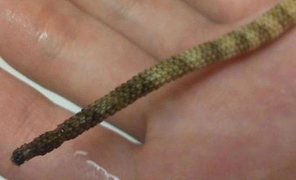 What is Shedding?